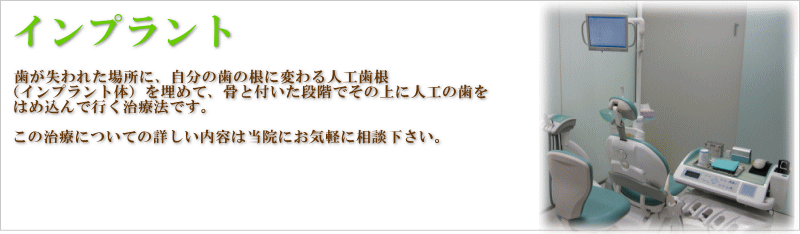 �C���v�����g